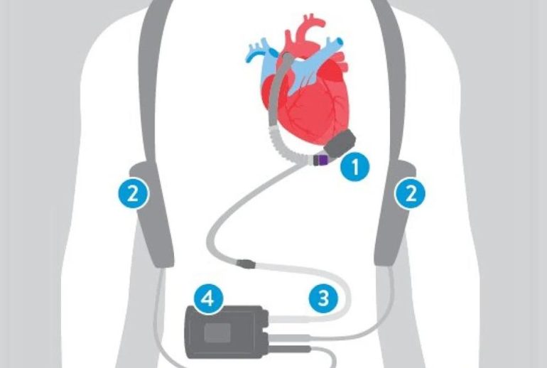 1734369894.983031_707748_image