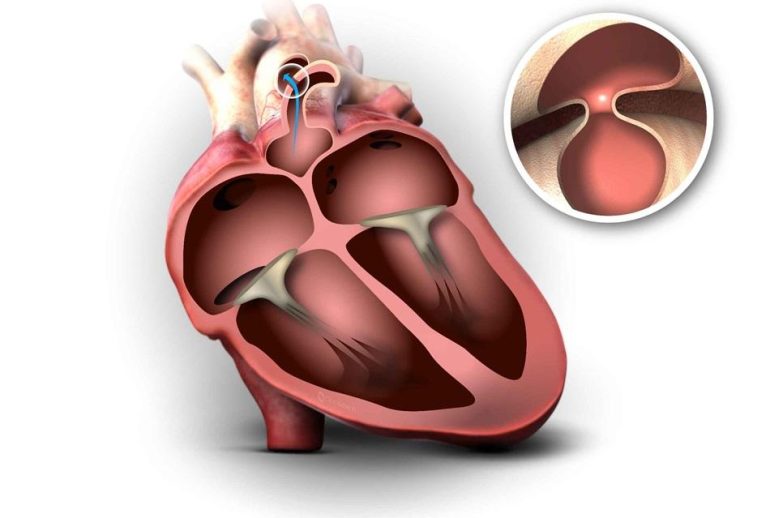 1734370072.870782_800201_image